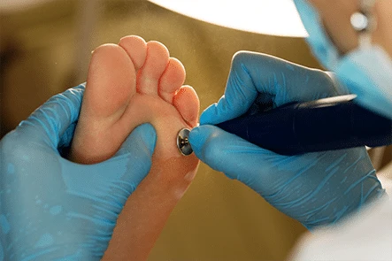 doctor using a tool on a patients bare foot