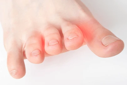 patients bare toes highlighted red