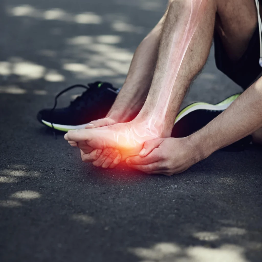 How to Treat Heel Pain After Running | Brooks Running | Brooks Running
