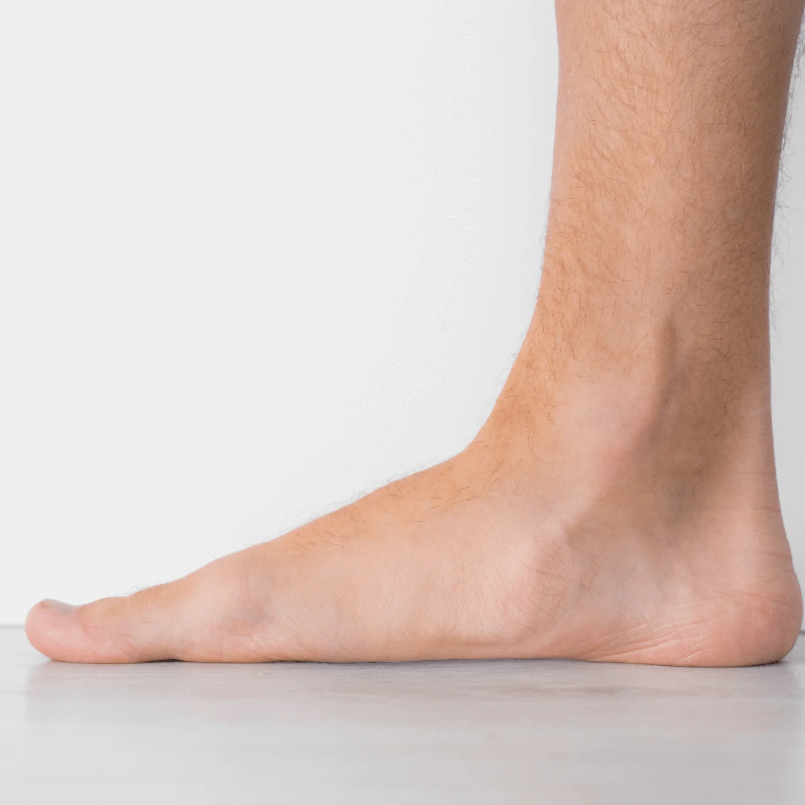 Flat Foot Causes and Treatment