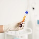 PRP Injections A Guide to Natural Pain Relief