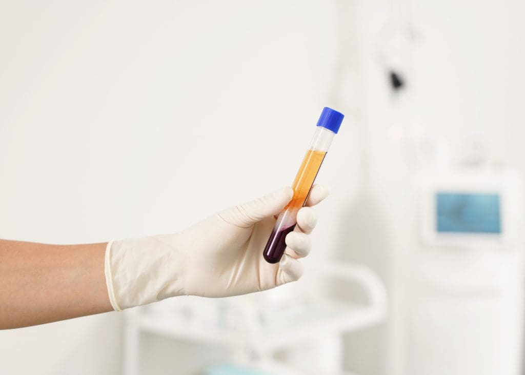 PRP Injections A Guide to Natural Pain Relief
