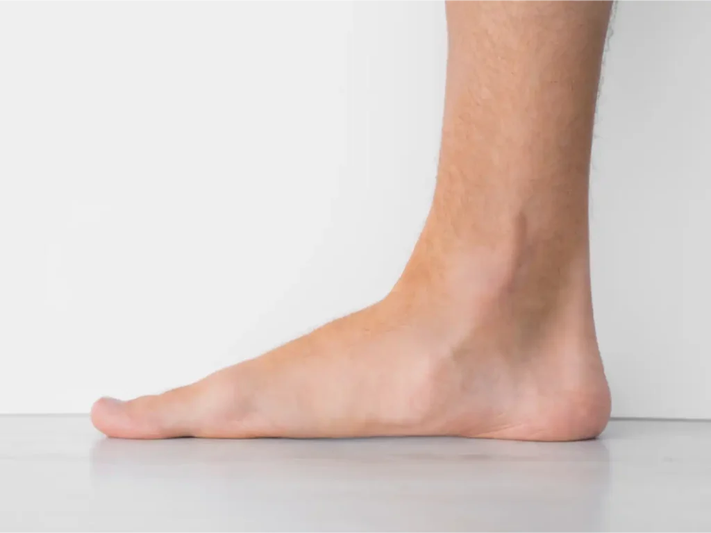 Side view of a foot and ankle while standing