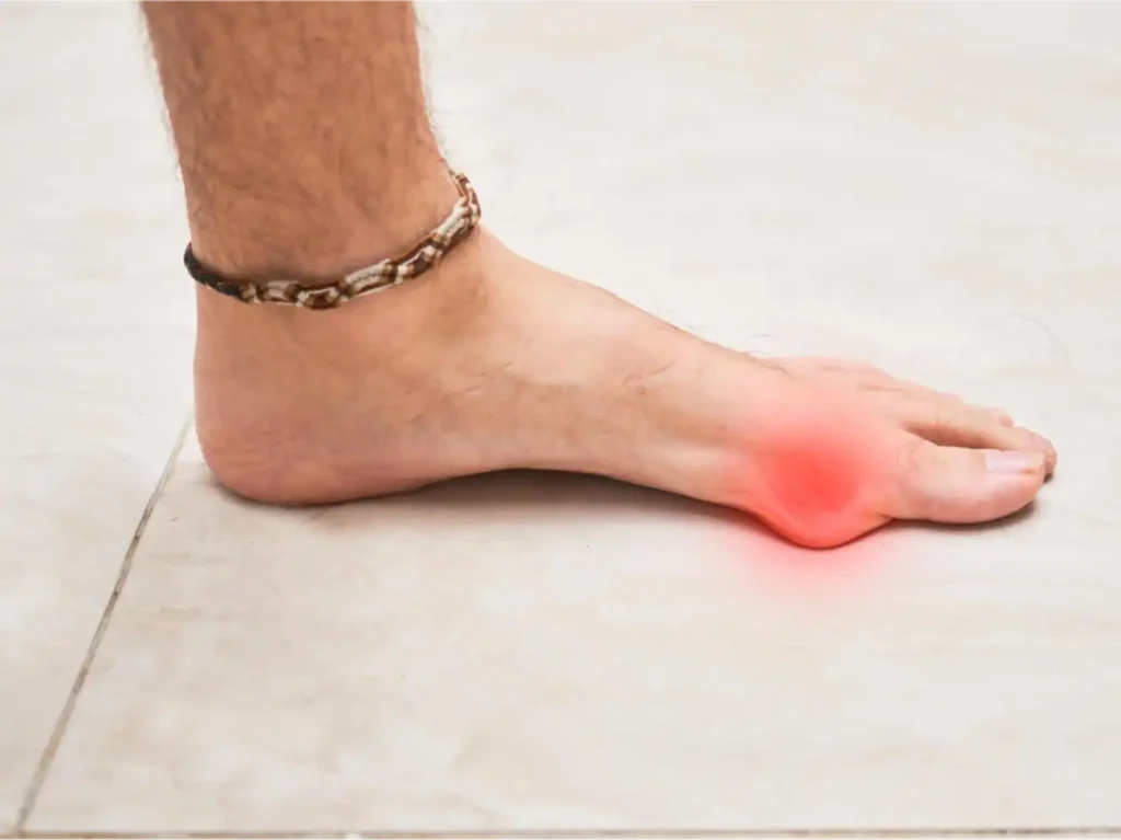 Redness and pain around the base of the big toe